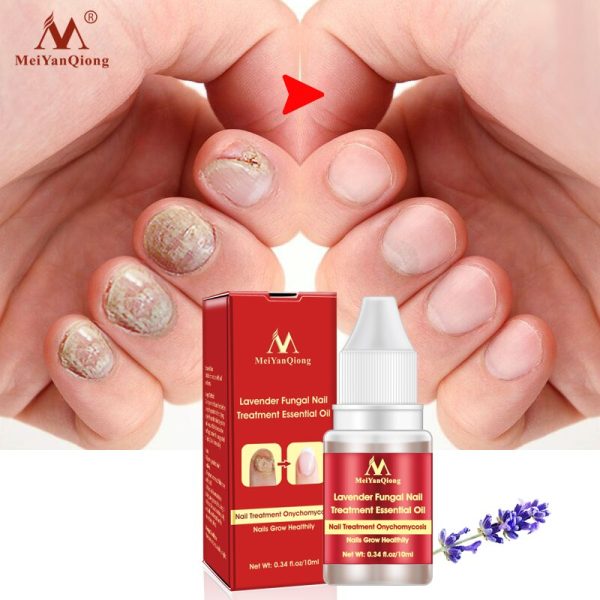 Meiyanqiong Lavender Fungal Nail Treatment Essential Oil Promote Nails Grow Healthy Nail Treatment Onychomycosis Foot Care